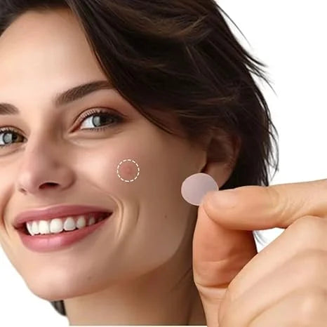 ClearGlow Acne Pimple Patches